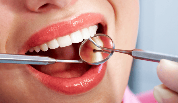 Basic Dental Services That Everyone Needs